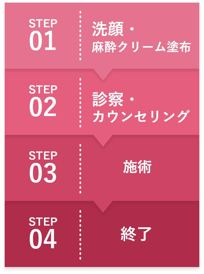 STEP1:洗顔・ 麻酔クリーム塗布、STEP2:診察・ カウンセリング、STEP3:施術、STEP4:終了