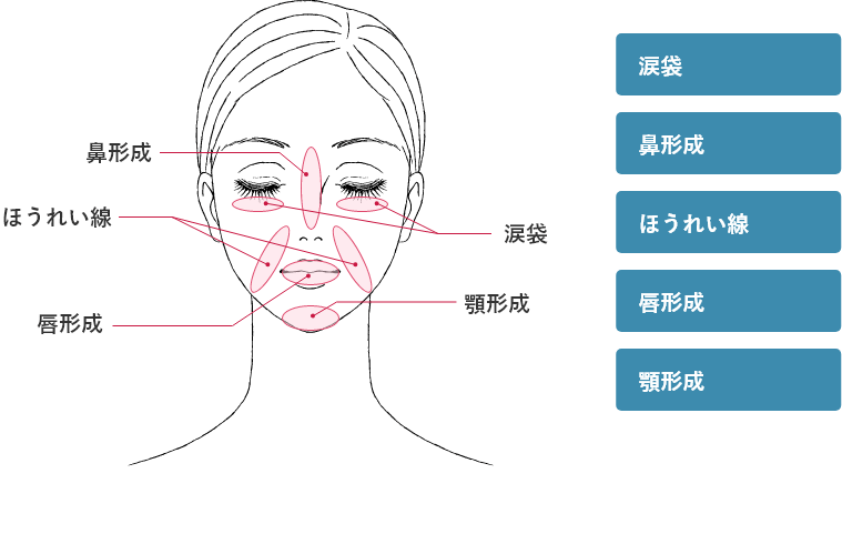 施術部位（涙袋、鼻形成、ほうれい線、唇形成、顎形成）